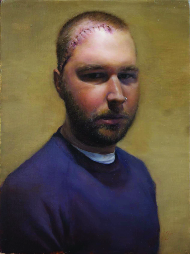 Portrait of a man with stitches